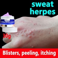 krim gatal kulit ubat gatal ubat gatal kulit eczema cream psoriasis cream cream gatal gatal celah ka