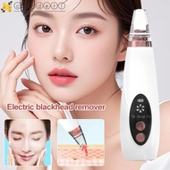 CORDELL Pore Cleaner, Vacuum Suction Water Cycle Blackhead Remover, Black Spots Cleaner Electric Too