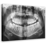 Dental X-Ray Teeth Poster Canvas Paintings Wall Art Modern Picture Print Living Room Bedroom Office 