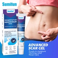 [Ready Stock] sumifun Russian Scar Cream External Use Burn Acne Mark Scar k10355WJG