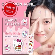 Hello Kitty Acne Patch Pe Acne Covering Patch Sanlio Acne Series Non-irritating Cover Y7i0