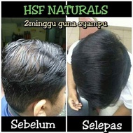 detox kuping kulit kepala