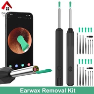 Ear Wax Removal Tool with Camera 1296P HD Otoscope Ear Cleaner Wireless Ear Otoscope Earwax Removal Kit Compatible with iOS Android SHOPCYC4578