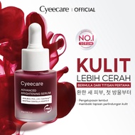 Cyeecare Advanced Peeling Serum AHA/BHA/PHA/LHA Fade Dark Spot & Acne Glowing Glass Skin (20g)