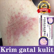 Ubat gatal kulit eczema cream psoriasis cream itchy skin cream krim gatal kulit ubat gatal herba cin