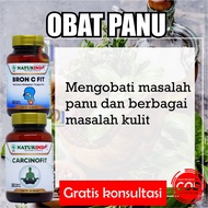 Obat panu kadas kurap kudis tablet buras penyakit kulit di tubuh wajah bercak putih