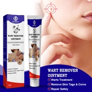 OUHOE Wart Removal Cream Krim Penghilang Lalat, Krim Penghilang Kutil, Mudah Dibawa Untuk Semua Kul