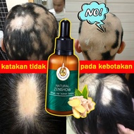 🔥[100% Asli ]serum penumbuh rambut terbaik-penumbuh rambut cepat dan tebal-Obat Botak Penumbuh Rambut Rontok Wanita dan Pria-Rambut Rontok Parah-Growth Serum Hair Growth Baldness-penumbuh rambut botak pria gluwty penumbuh rambut serum-Obat rambut botak