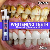 Whitening Toothpaste Probiotics 150g Pump Bottle Stain Remover for Coffee Tea Smoking Stains Gum Pro