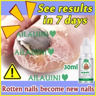 ◹ ۩ ◰ ️️Bonil Anti Fungal Solution 50ml Nail Repair Nail Fungal Treatment Anti-fungal Care Set Tool