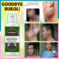 Bitoon Herbal Oil Pure Extract: Effective Gamot Pantunaw / Pantanggal ng mga Bukol sa katawan