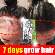 🔥SG stock🔥ginger shampoo hair loss shampoo Ginger Plant Extract Anti-Hair hair growth shampoo hair fall shampoo