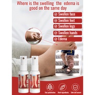 Body Edema Relief Spray Edema Relief Spray for Edema Relief