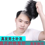 Thin Men's Wig Men's Wig Bald Wig Bald Cover Wig Black natural