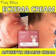 Tiny Bliss Baby ezcema cream Diaper rash creams Antiseptic Healing Cream baby care cream 50g