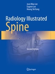 Radiology Illustrated: Spine Joon Woo Lee