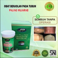 ( TERLARIS ) SALEP KHUSUS BENJOLAN AR-RAIHAN - MENGOBATI BENJOLAN - GONDOK - TUMOR  obat kista  benjolan kista Qahira minyak Qahira salep benjolan lipoma salep untuk mengatasi benjolan lipoma salep terbaik