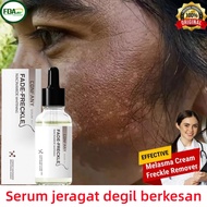 dark spot serum Jeragat Degil Berkesan serum jeragat melasma whitening brightening freckle pigmentat