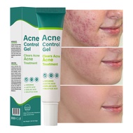 Salicylic Control Acne Gel Reduces Acne Marks Anti-Acne Repair Pimple Acne Scar Skincare