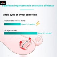 2Pcs Ingrown Toenail Corrector Tools Pedicure Recover Embed Toe Nail Professional Ingrown Toenail St