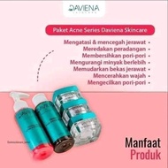 Daviena skincare 1 paket acne