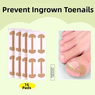 IMLUCKY | Corrective Isolation Toe Pad