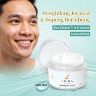EFFECTIVE Acne Scar Cream Acne Scar Remover acne remover acne medication acne ointment acne spot tre