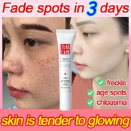 Whitening melasma cream original pekas cream eraser original japan Anti Aging Serum Pekas Remover Cr