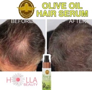 Arbutina O Oil Hair Growth &amp; Hair Loss Serum / Umbuh Rambut / Serum