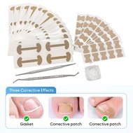 [kanye2dc] Ingrown Toenail Correction Kit Ingrown Toenail Correction Strips Pedicure Tools