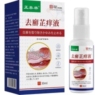 [Ready Stock] Remove Itchy Skin Itchy Red Herbal Antibacterial Itchy Itchy Spray Support WJG
