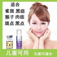 点痣祛痣祛斑点痣膏点斑去斑去痣水无痕脸部黑肉痣祛雀斑产品Spot spot spot spot spot spot spot spot spot spot spot spot spot spot sp