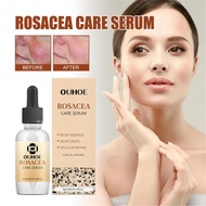 Rosacea เซรั่มบำรุงผิวสีแดงเซรั่มลดรอยแดงให้ความชุ่มชื้นเซรั่ม F-Acial เพื่อซ่อมแซมผิวหนัง1ฟลอซ์