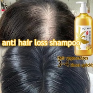 Shampoo Hair Loss Anti Hair Loss Shampoo Moisturize Hair Roots Remove Oil Refresh Ginger Care Nourish Hair Follicles