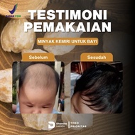 Minyak Kemiri Bakar Asli 100 Original Penumbuh Penyubur Rambut Untuk Bayi Dan Anak 2 Tahun Cepat Teb