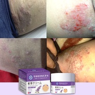 Private Antibacterial Cream for Itchy Skin, Itchy Genitals, Chinese Herbal Itch Relief Cream for Pri