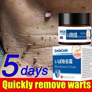 Mole cream warts removal cream concentrated potent mole removal skin tag remover cream tag solution