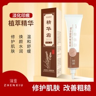 Barangan Spot # Krim Pati Licin Kulit Malu Membaiki Herba Tanda Regangan Cacar Mencairkan Tanda Tand