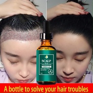 Obat penumbuh rambut penumbuh rambut botak serum penumbuh rambut Scalp