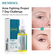 HEMEIEL Pimple Marks Acne Remover | Back Acne Treatment Serum Set |Adapalene Clindamycin pimples acn