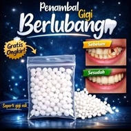 Instant Cavity Filling | Practical, Safe, and Cavity Fillings