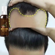 【SG Stock】Hair Growth Serum Hair Loss Care Shampoo Hair Tonic For Hair Growth 500ml Anti Hair Fall T