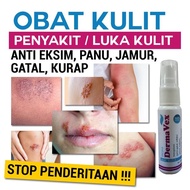 uj3049 Obat Kulit HERBAL 100 Persen Ampuh