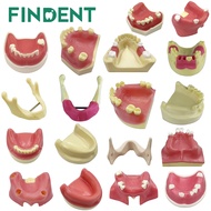 1Pcs Dental Implant Practice Model Maxillary Mandibular Basic Implant Training Model With Soft Gums 