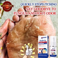 Herbal anti fungal spray foot deodorant foot spray deodorant Say Bye to Fungus and Athlete Feet for 