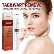 3ml Wart Treatment Pen Skin Tags Moles Remover Warts Corn Remover