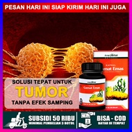 Obat Tumor Tumor Benjolan Tumor Jinak Tumor Ganas Tumor Payudara Tumor Otak Tumor Paru Paru Tumor Ra