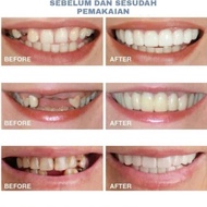 Promo Snap On Smile Gigi Palsu Instan Atas Bawah 100% Ori Perapi Gigi