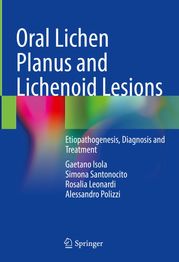 Oral Lichen Planus and Lichenoid Lesions Gaetano Isola