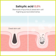 – ∭ ✧ [COSRX OFFICIAL] 1+1 Salicylic Acid Daily Gentle Cleanser Set, Salicylic Acid 0.2%, Improve A
